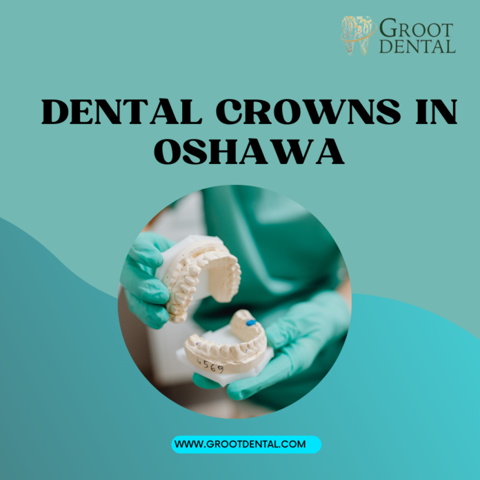 Dental Crowns in Oshawa